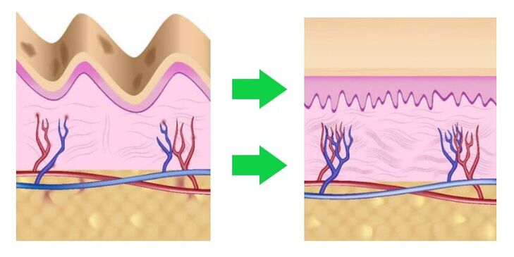 Intenskin allinea la pelle