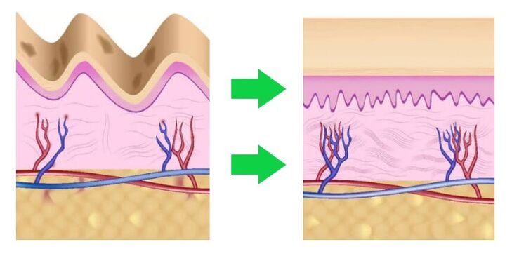 Intenskin uniforma la pelle